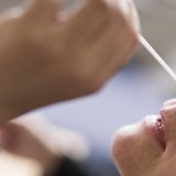 La raréfaction de ce geste depuis le début de l'année a pesé lourd sur les résultats semestriels de Roche. (archive)